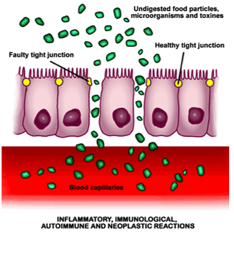 inflammation