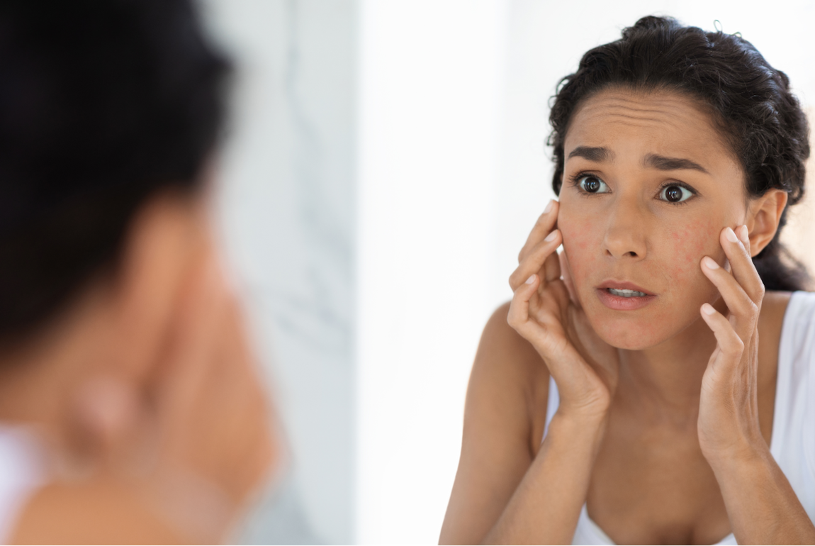 Woman looking frustrated with her dark spots